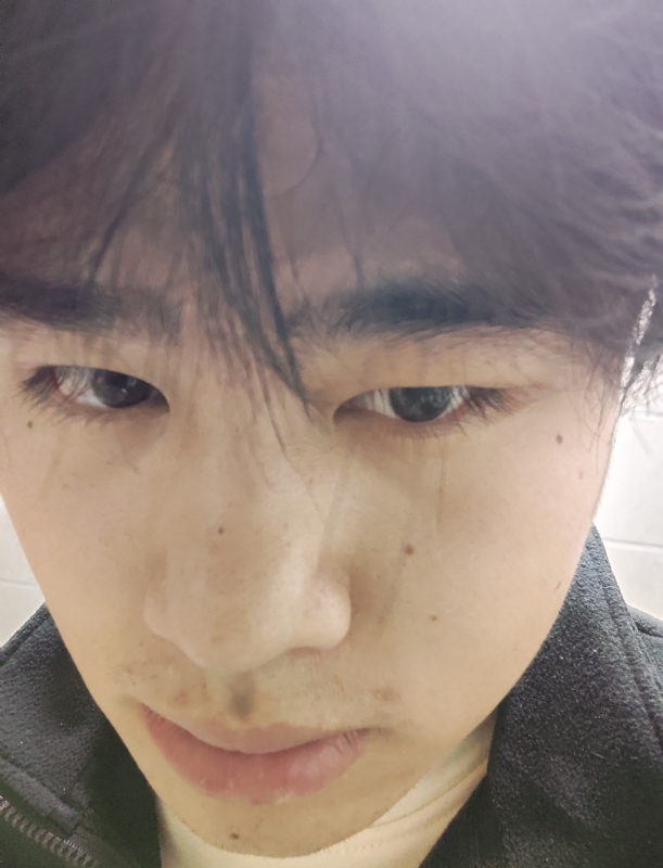 伤男的第一张照片--平顶山认干亲服务网